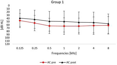 Hyperbaric oxygen therapy as an adjunct to corticosteroid treatment in sudden sensorineural hearing loss: a retrospective study